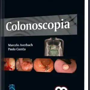 Colonoscopia 2 edición