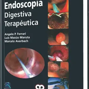 Endoscopia Digestiva Terapéutica