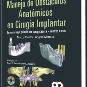 Manejo de Obstáculos Anatómicos en Cirugía Implantar