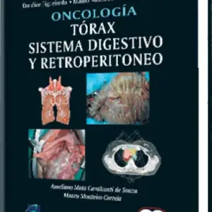 Oncología. Tórax, Sistema Digestivo y Retroperitoneo