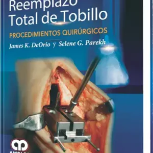 Reemplazo Total de Tobillo