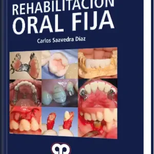 Rehabilitación Oral Fija