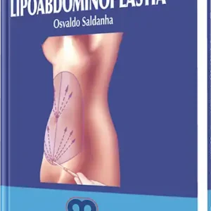 Lipoabdominoplastia
