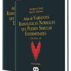 Atlas de Variantes Radiológicas Normales que Pueden Simular Enfermedades. 9 Edición