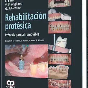 Rehabilitación Protésica. Prótesis Parcial Removible