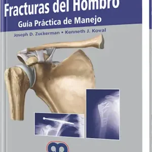 Fracturas del Hombro. Guía Práctica de Manejo