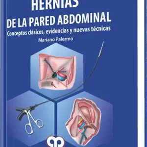 Hernias de la Pared Abdominal