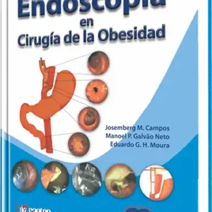 Endoscopia en Cirugía de la Obesidad
