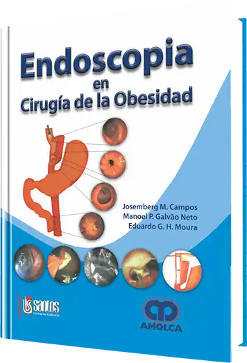 Endoscopia en Cirugía de la Obesidad