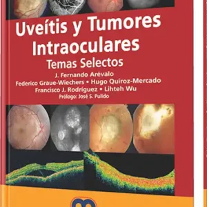 Uveítis y Tumores Intraoculares