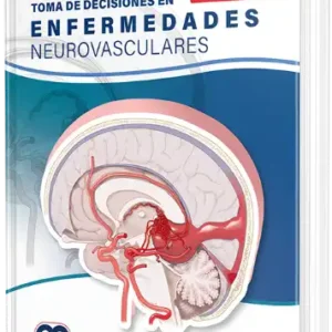 Toma de Decisiones en Enfermedades Neurovasculares