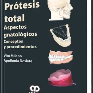 Prótesis Total