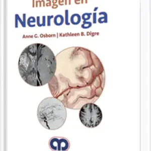 Imagen en Neurología