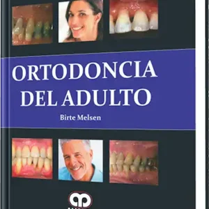 Ortodoncia del Adulto