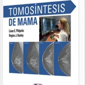 Tomosíntesis de Mama