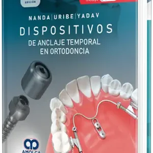Dispositivos de anclaje temporal en ortodoncia 2a. Edición