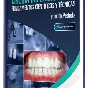 Cirugía Implantológica. Fundamentos Científicos y Técnicas