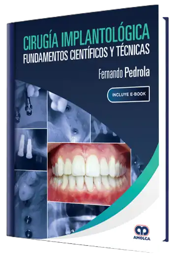 Cirugía Implantológica. Fundamentos Científicos y Técnicas