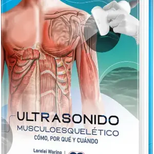 Ultrasonido musculoesquelético. Cómo, por qué y cuándo