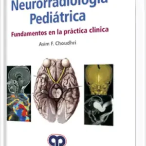 Neurorradiología Pediátrica