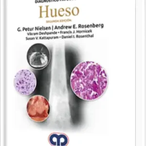 Diagnóstico Patológico: Hueso 2 Edición