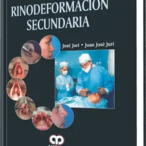 Rinodeformación Secundaria