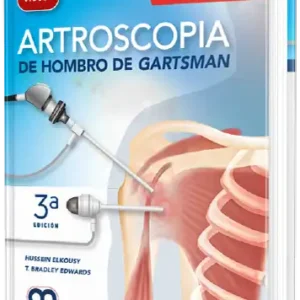 Artroscopia de Hombro de Gartsman