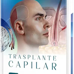 Trasplante capilar. 6.a edición