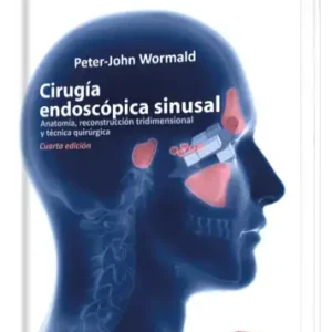 Cirugía Endoscópica Sinusal.  4 Edición