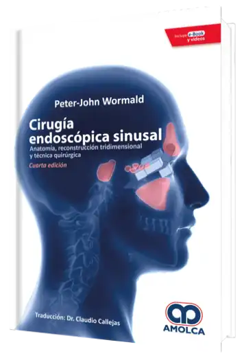 Cirugía Endoscópica Sinusal. 4 Edición