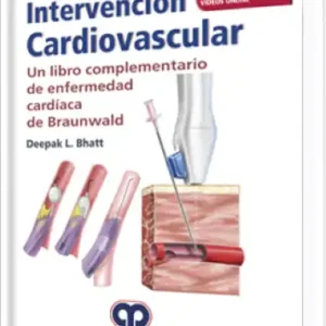 Intervención Cardiovascular