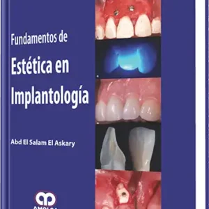 Fundamentos de Estética en Implantología