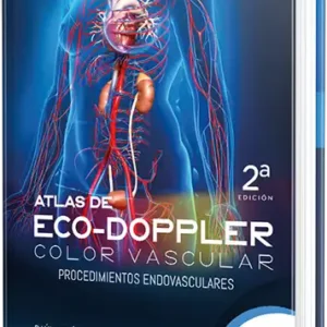 Atlas de Eco-doppler color vascular. Procedimientos endovasculares