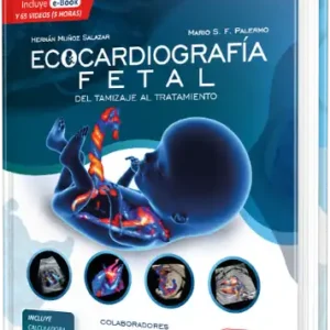 Ecocardiografía Fetal. Del Tamizaje al Tratamiento