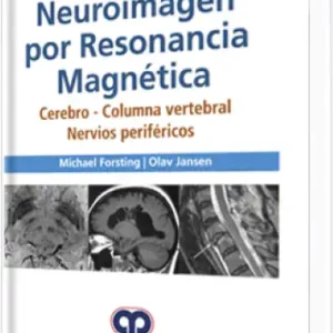 Neuroimagen por Resonancia Magnética