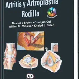 Artritis y Artroplastia. Rodilla
