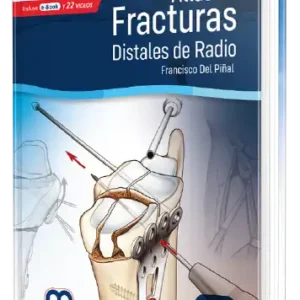 Atlas de Fracturas Distales de Radio
