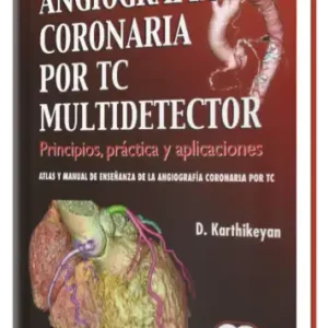 Angiografía Coronaria por TC Multidetector
