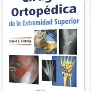Cirugía Ortopédica de la Extremidad Superior