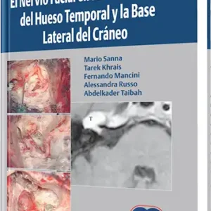 El Nervio Facial en la Microcirugía del Hueso Temporal y la Base Lateral del Cráneo