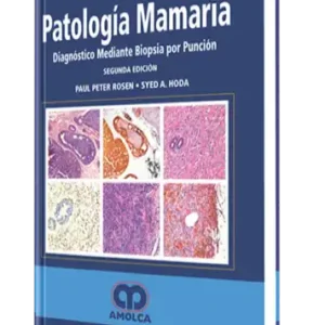 Patología Mamaria. Diagnóstico Mediante Biopsia por Punción 2 Edición