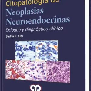 Citopatología de Neoplasias Neuroendocrinas