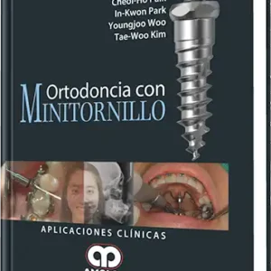 Ortodoncia con Minitornillo
