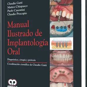 Manual Ilustrado de Implantología Oral