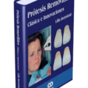 Prótesis Removibles Clásica e Innovaciones