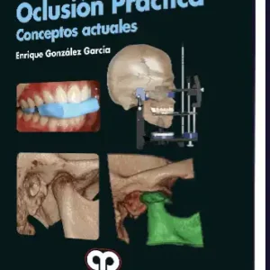 Oclusión Práctica - Conceptos Actuales. 2 Edición