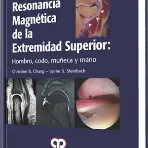 Resonancia Magnética de la Extremidad Superior