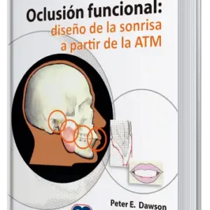 Oclusión Funcional: Diseño de la Sonrisa a Partir de la ATM