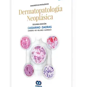 Diagnóstico Patológico Dermatopatología Neoplásica 2 Edición