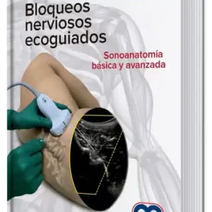 Bloqueos Nerviosos Ecoguiados. Sonoanatomía Básica y Avanzada